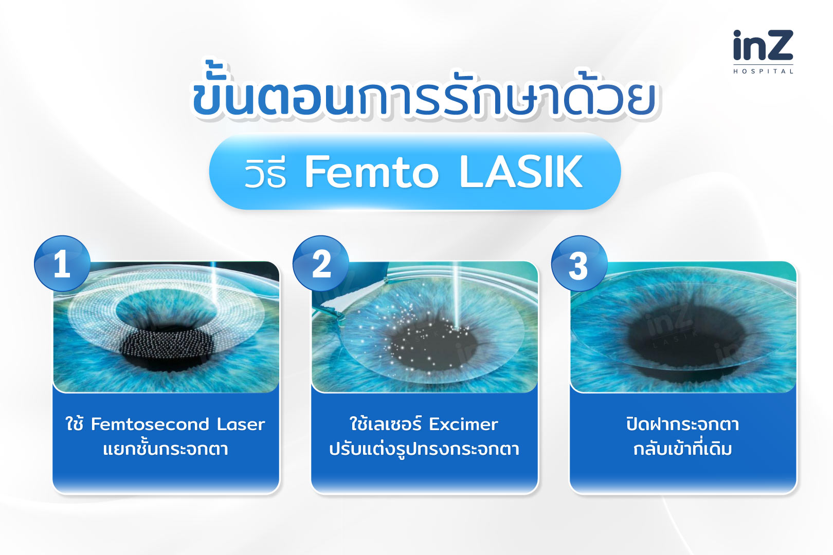 ขั้นตอนการทำเลสิก femto