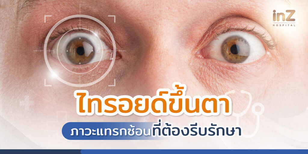 รู้จักอาการไทรอยด์ขึ้นตา