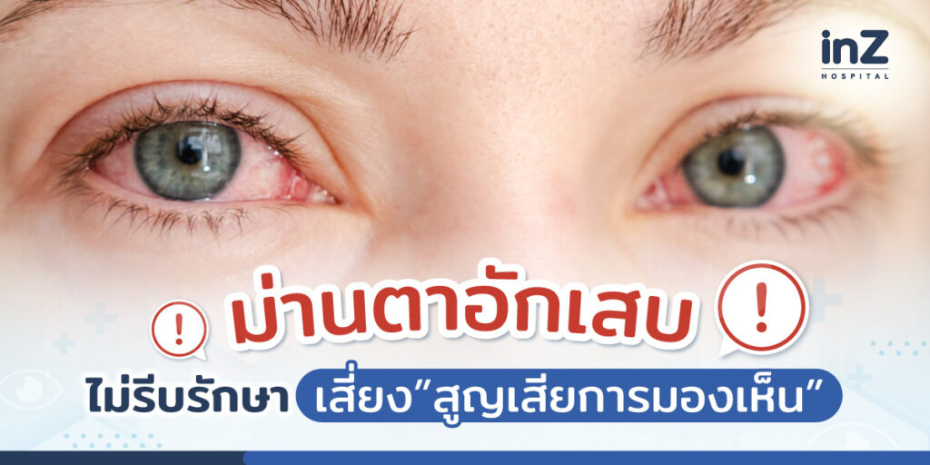 โรคม่านตาอักเสบ