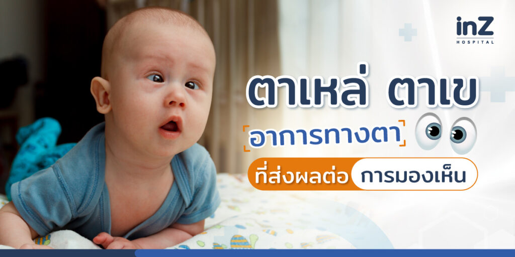 ตาเข คือ