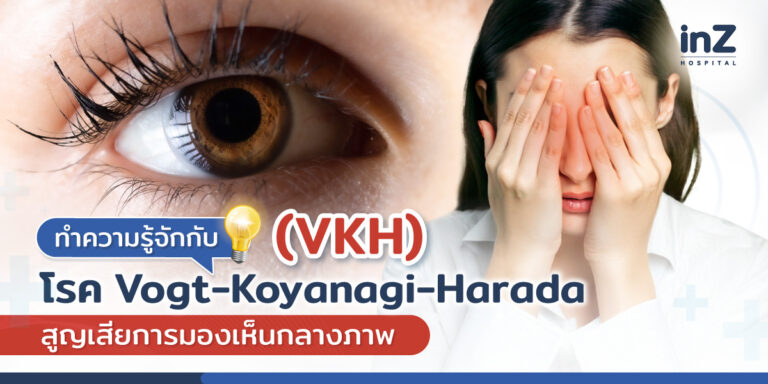 Vogt-Koyanagi-Harada (VKH)