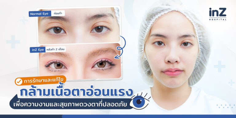 กล้ามเนื้อตาอ่อนแรง (Ptosis)