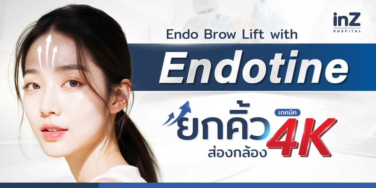 Endo Brow Lift