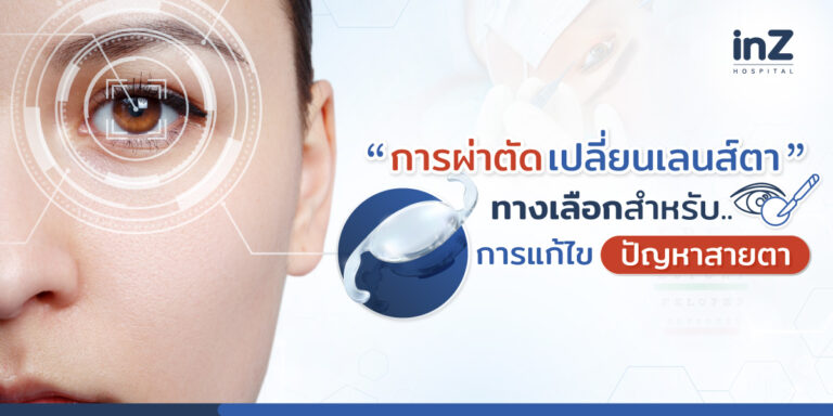 การผ่าตัดเปลี่ยนเลนส์ตา : ทางเลือกสำหรับการแก้ไขปัญหาสายตา