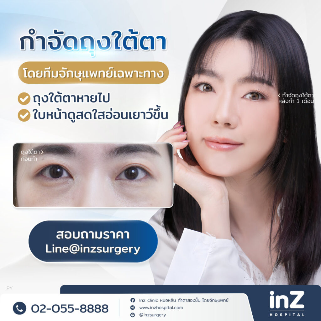 โปรโมชั่น กำจัดถุงใต้ตา