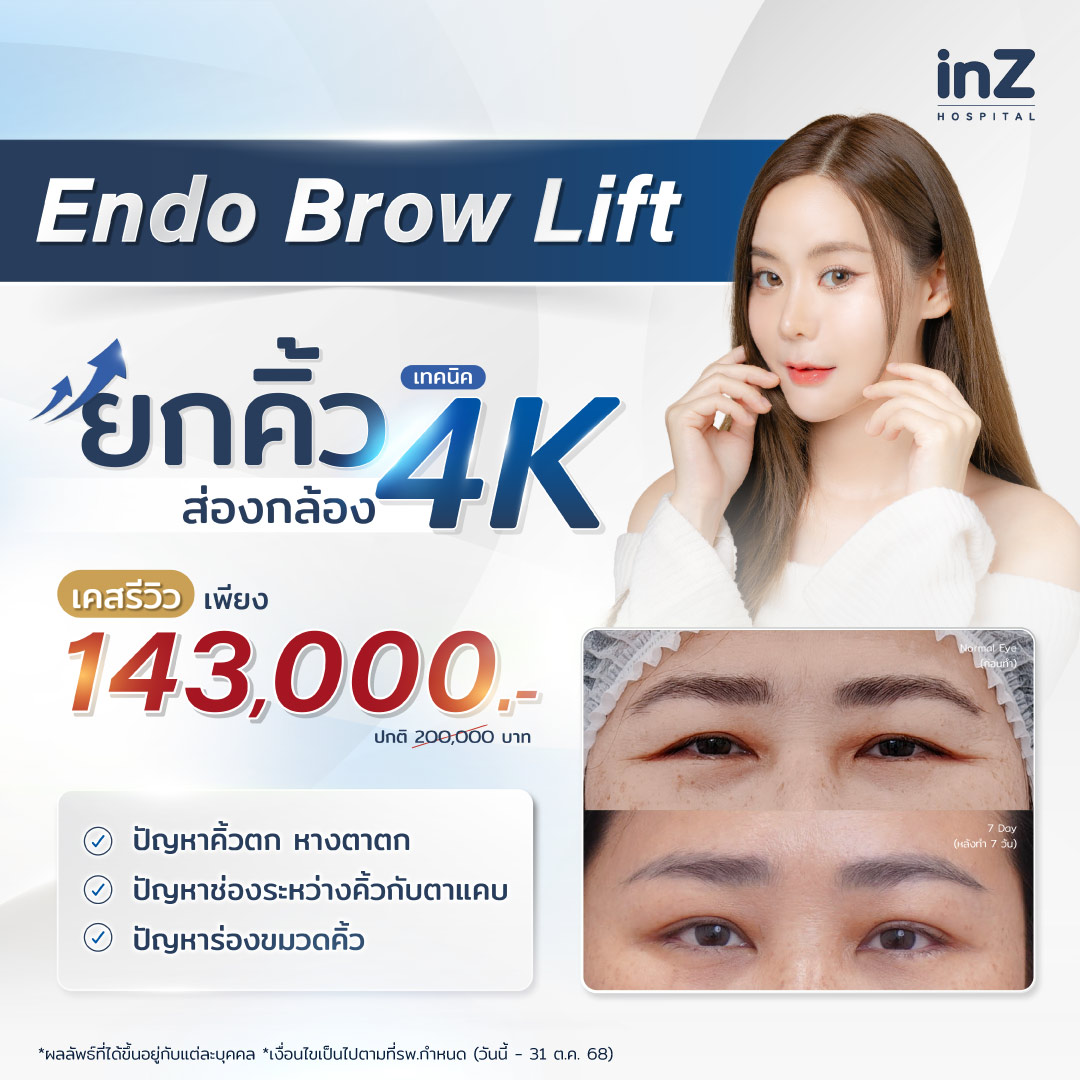 ยกคิ้วส่องกล้อง