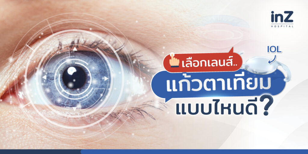 เลือกเลนส์แก้วตาเทียม (IOL) แบบไหนดี?