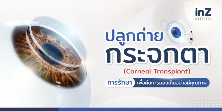 ปลูกถ่ายกระจกตา (Corneal Transplant) การรักษาเพื่อคืนการมองเห็นอย่างมีคุณภาพ 