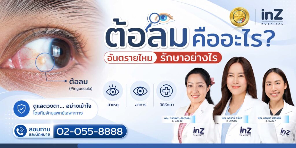 รักษาต้อลม