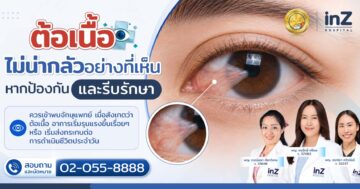 รักษาต้อเนื้อ